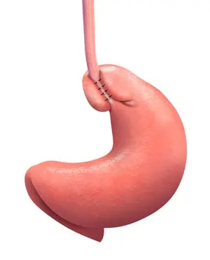 reflux
